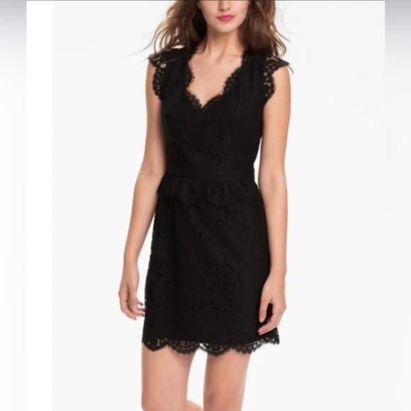 Joie Dresses & Skirts - Joie Black Sleeveless Lace Dress XSmall - Beautiful -